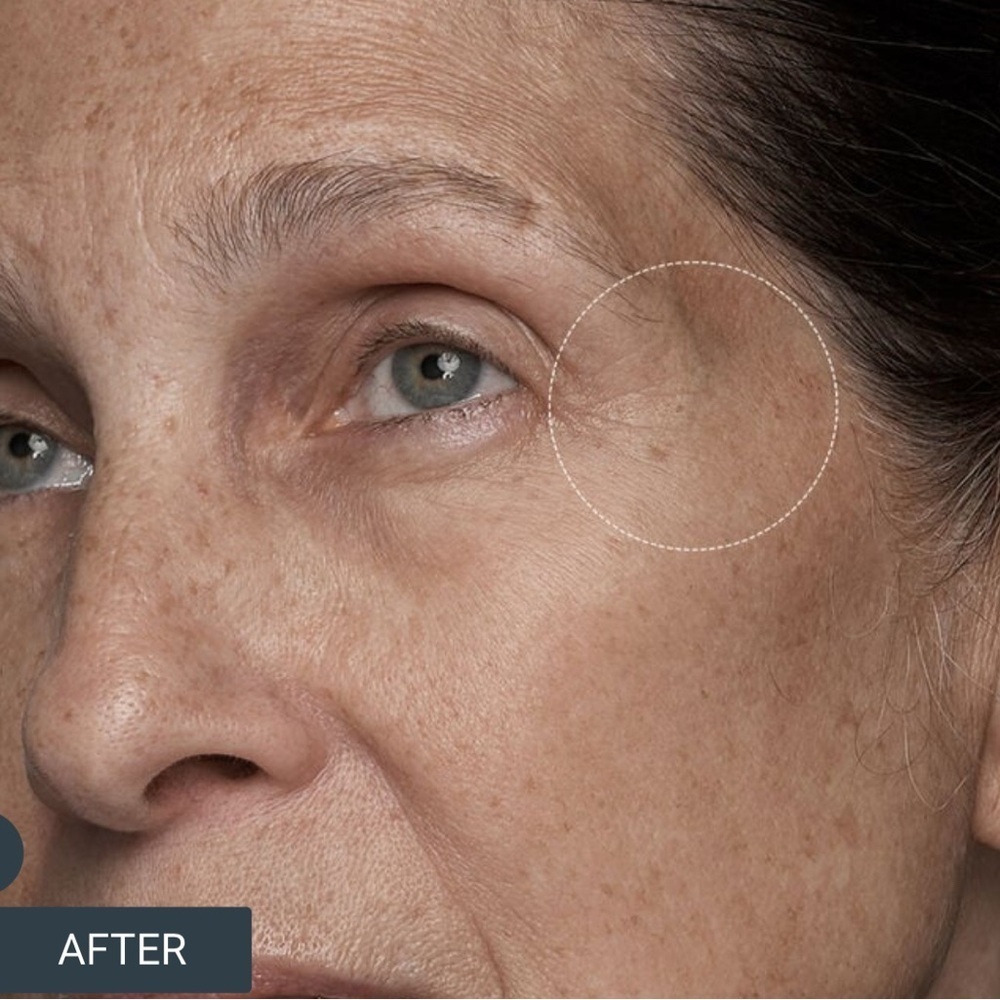 Fresh Black Tea Advanced Age Renewal Eye Cream - Picture 9 of 13